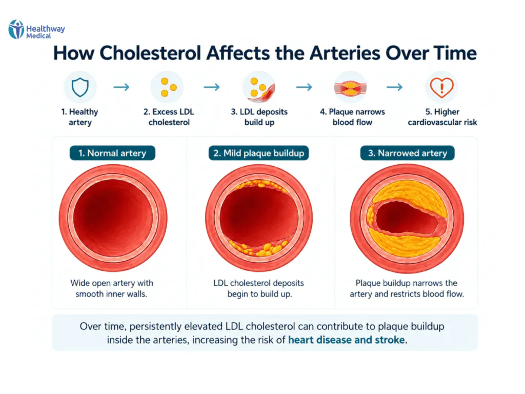 Aterosklerosis