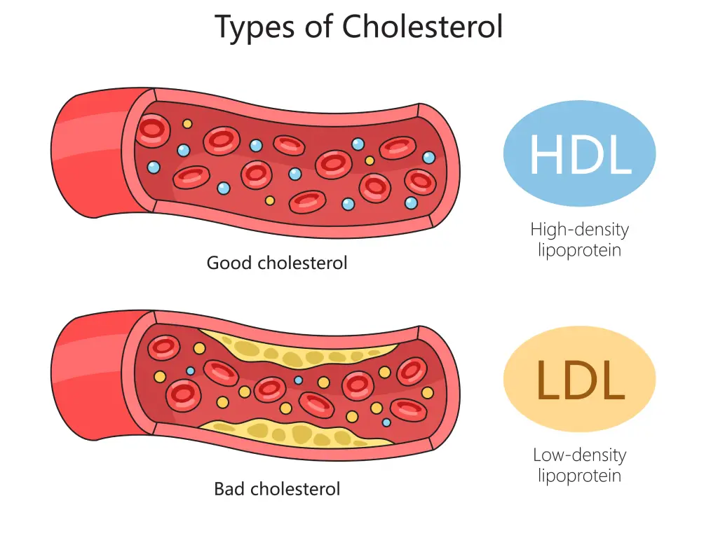 Good Cholesterol VS Bad Cholesterol